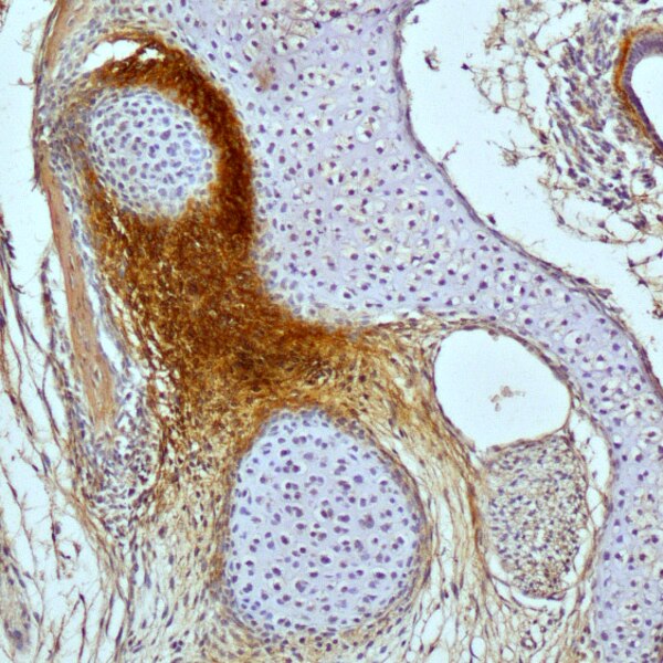 Immunohistochemistry image of the middle ear region of a postnatal day 5 opossum labeled with DSHB anti-versican [12C5] (brown). PMID: 32600529, Fig. 6D.